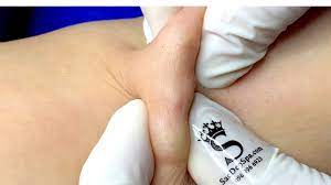 Relax Every Day With Sac Dep Spa 0200 Youtube In 2021 Zits Popping Skin Care Pimples Beauty Skin Care Routine