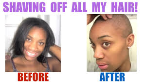 Celebrities like jada pinkett smith have been vocal about their own journey of dealing with alopecia. Shaving My Head Bald Big Chop Hair Loss Alopecia Areata March 26 2013 Youtube