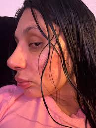 Two weeks post op and I'm very worried I might have saddle bridge . ? My  surgeon had to break my nose because I had deviation and so it's still  swollen. My