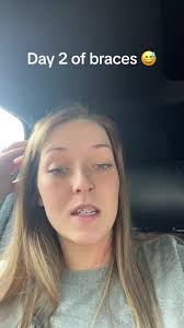 Day 2 of braces and boy are they sore… lets hope it gets better by the end  of the week. #braces #fyp #fy #bracesjourneybegins #supersore