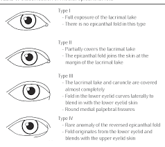 However, variation occurs in the nature of this feature and the possession of 'partial epicanthic folds' or 'slight epicanthic folds' is noted in the relevant literature. Table 1 From Medial Epicanthoplasty Using A Modified Skin Redraping Method Semantic Scholar
