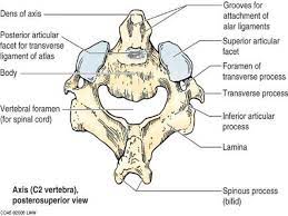What vertebrae could be described as 'a ring of bone'. Comparative Study Of Vertebral Column Of Camel Ox And Horse