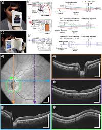 If you have a hidpi display (retina), find uiscale and change aq== to ag==. Clinical Translation Of Handheld Optical Coherence Tomography Practical Considerations And Recent Advancements