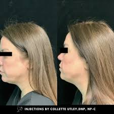 TOP 10 BEST Cosmetic Dermatologists in Nashville, TN