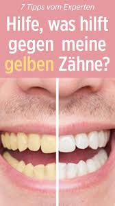Sieben Tipps Gegen Gelbe Zahne Und Verfarbungen Gelbe Zahne Zahnbelag Entfernen Zahne