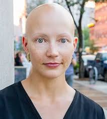 Person with head hair shaved very short or off all together; A Great Biography Of Writer Helen Phillips Bald Head Women Bald Head Girl Shave Eyebrows