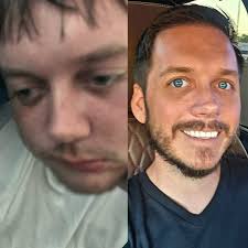 Last night about midnight, woke up and had to take a shot!