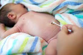 Tali pusat terdapat antara pusat janin dan permukaan fetal plasenta. 5 Perawatan Tali Pusat Bayi Baru Lahir Agar Cepat Kering