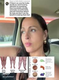 Signs of Lipedema: Identifying Symptoms and Understanding This Condition