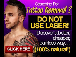 Laser tattoo removal in madison on yp.com. How To Get Rid Of Stick And Poke Tattoo Www Svbranchesinc Com