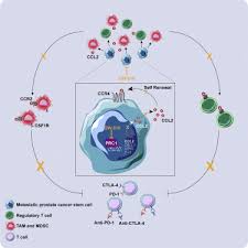 To assess the clinical characteristics and outcome of patients with liver metastases in prostate carcinoma. The Polycomb Repressor Complex 1 Drives Double Negative Prostate Cancer Metastasis By Coordinating Stemness And Immune Suppression Sciencedirect