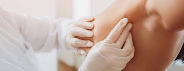 Image result for Mastectomy