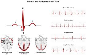 Fetal Arrhythmias | Glowm