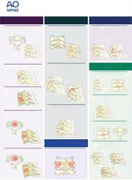 Image result for Subaxial Injury Classification Scale