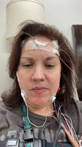 Natalie Craig Sleep Apnea