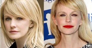 Kathryn Morris Plastic Surgery Rumor Or Real Lip Fillers Kathryn Morris Celebrity Plastic Surgery