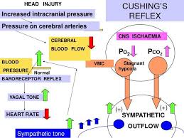 Image result for Cushing Response