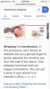 Frustrated With Ob Won T Strip Membrane 1st Pregnancy Forums What To Expect