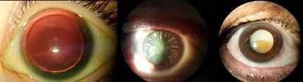 Image result for Isoglossa cataractarum