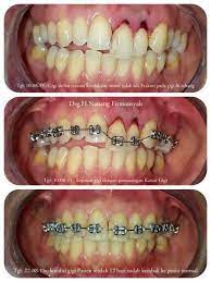Pin On Ortho