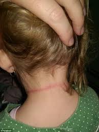 Stacked neck length hairstyle with layers. Brisbane Toddler Escapes Being Strangled By Her Big Sister S Hair Daily Mail Online