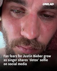 His posts over recent months have left people worried 😧