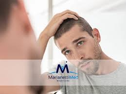 La caduta di capelli in condizioni normali è da ritenersi un naturale processo fisiologico di ricambio della capigliatura. Addio Alla Perdita Dei Capelli Con La Terapia Rigenerativa Del Cuoio Capelluto Marianettimed