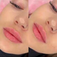 ℂ𝕠𝕤𝕞𝕖𝕥𝕠𝕝𝕠𝕘𝕪 🤍 (@dr.dianaesthet) • Instagram photos and videos