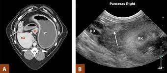 Your pooch may show signs of jaundice. Small Animal Abdominal Ultrasonography Today S Veterinary Practice