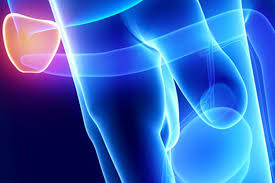 5 warning signs now, there are lots of different warning signs. Prostate Cancer Signs Diagnosis Treatment In Singapore Pcc Singapore