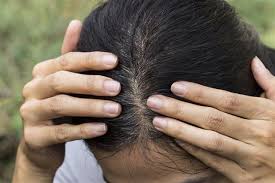 6 using natural safflower oil for hair can help keep your hair shiny and radiant, and it is free of harsh chemicals often found in commercial shampoos. These Benefits Prove Why Safflower Oil Is Best For Hair Growth Hair Glamourista