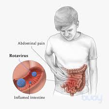 Image result for Rotavirus