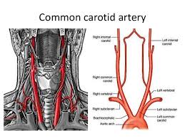 The external carotid artery stretches upwards from the level of upper border of the lamina of the thyroid cartilage to a stage supporting the neck of the mandible, where it ends in the substance of the parotid gland by splitting. Vessels Of Head Neck Amp Face