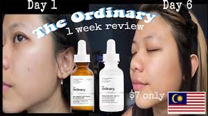 The cheapest the ordinary niacinamide 10% + zinc 1% price in malaysia is rm 21.00 from shopee. I Tried The Ordinary Niacinamide Rosehip Oil For 7 Days Honest Review Malaysia Youtube