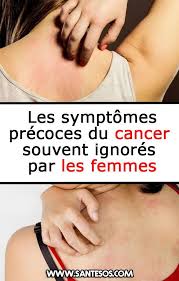 Only a doctor can tell if symptoms are caused by cancer or some other problem. Pin On Actualite Sante