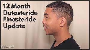 12 Month Before and After Finasteride & Dutasteride Update
