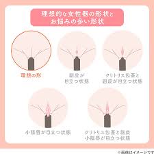 副皮切除｜ヒダの大きさを整えて汚れやにおいを防ぐ！効果・ダウンタイム・値段について｜美容整形・美容外科のTAクリニックグループ