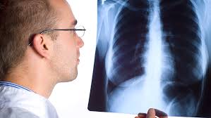 Division of Pulmonary, Allergy, Critical Care, and Sleep Medicine