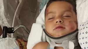 Fundraiser for Dystinie Snapp by Samuel Landis : Help the Snapp Familly