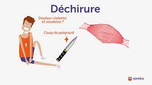 Comment soigner une déchirure musculaire. Soigner Une Dechirure Ooreka Fr Youtube