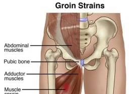 What Kind of Groin Pain Do You Have? – Squat University