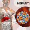 Ketahuai apa saja penyebab, gejala, dan pengobatannya hati (liver) termasuk organ pencernaan dan berperan penting terhadap proses metabolisme tubuh. 1