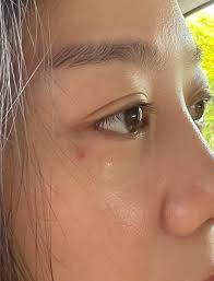 Herman Keh accidentally scratched Tasha Low's face while shooting a scene