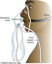 نتيجة بحث الصور عن ‪partial rebreather mask‬‏