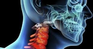 Localizarea ganglionilor limfatici în gât, pe care o vedeți în fotografia din dreapta. Gral Medical Ganglionii Informatii Care Iti Pot Salva Viata