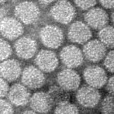 Maize chlorotic mottle virus (mcmv) and either maize dwarf mosaic virus (mdmv) or. Carmovirus Springerlink