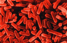 Image result for Legionella