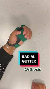 Image result for Radial Gutter Cast