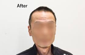 薄毛男性に似合う髪型って女性がかっこいいと思うヘアスタイル６選