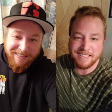 Shaving mishaps happen, is trimming a beard tricky?